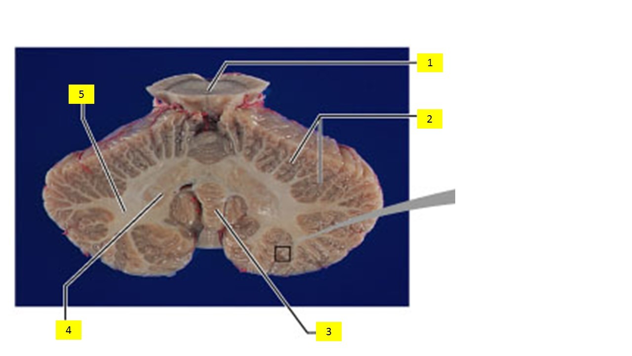 Card front image