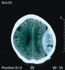 Card front image