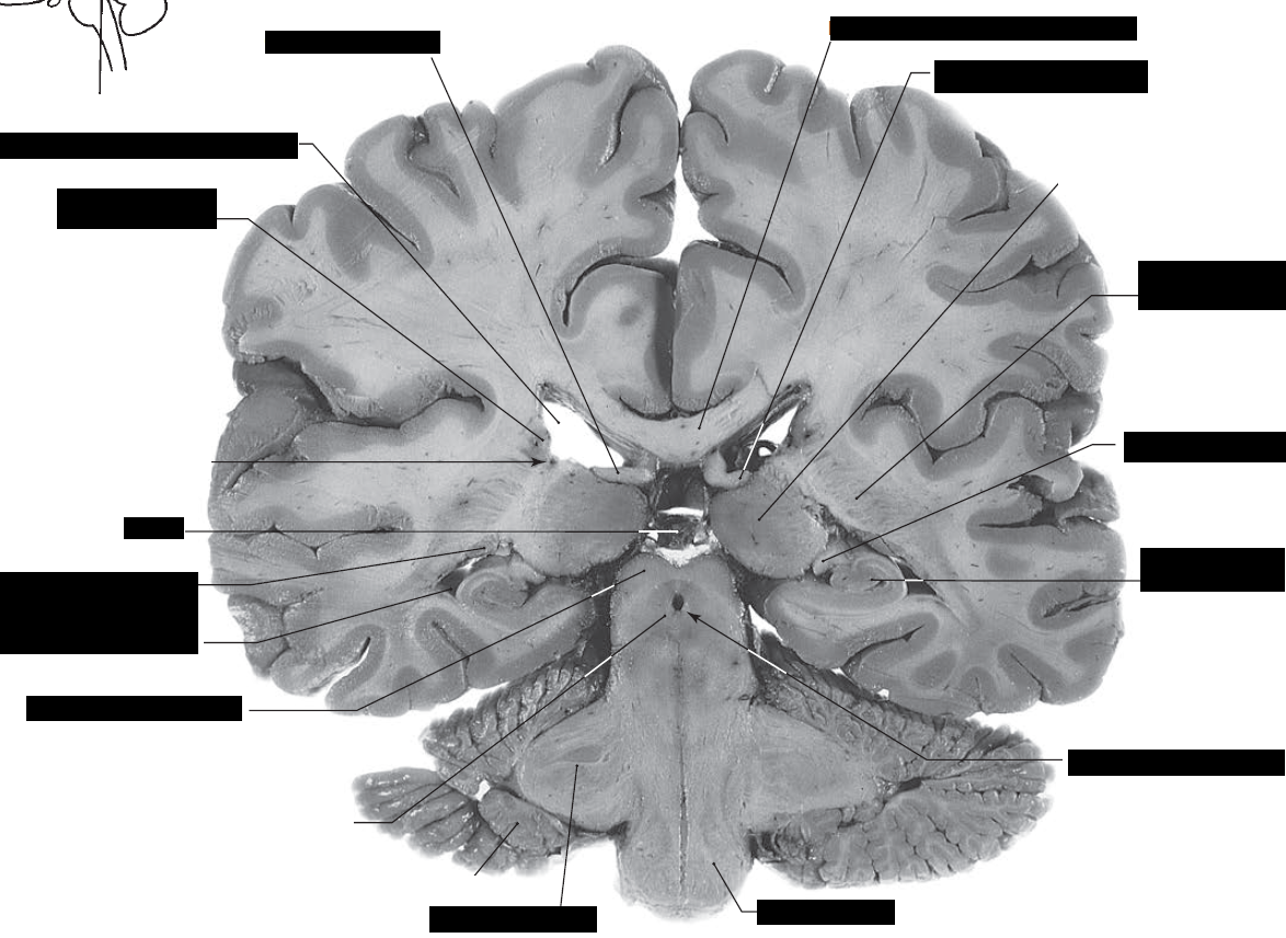 Card front image