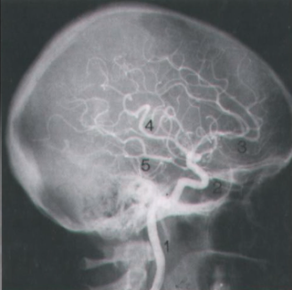 Card front image