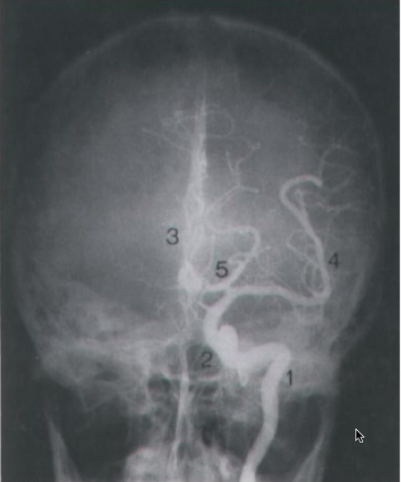 Card front image