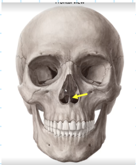 Card front image