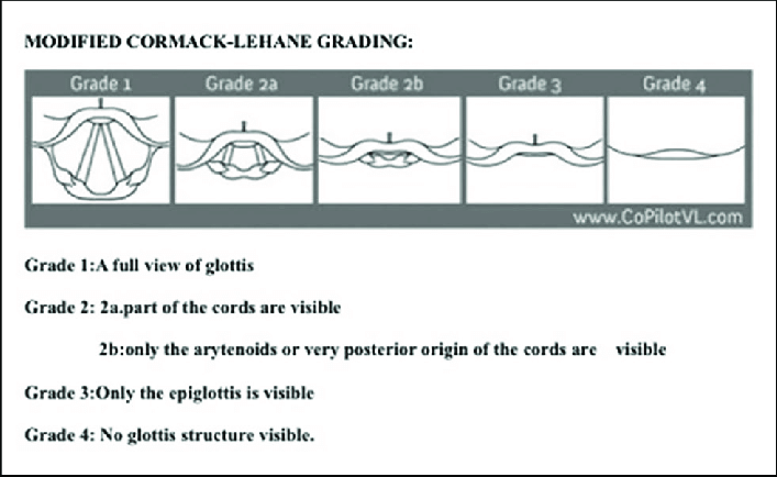 Card back image