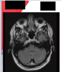 Card front image